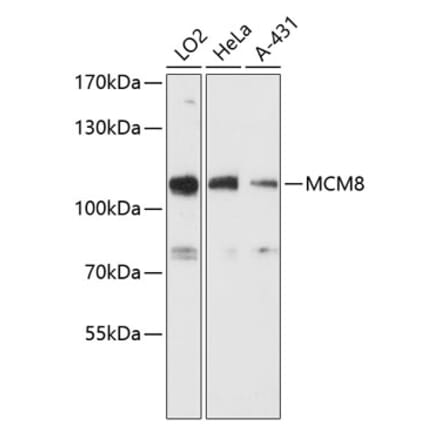 Western Blot - Anti-MCM8 Antibody (A87892) - Antibodies.com