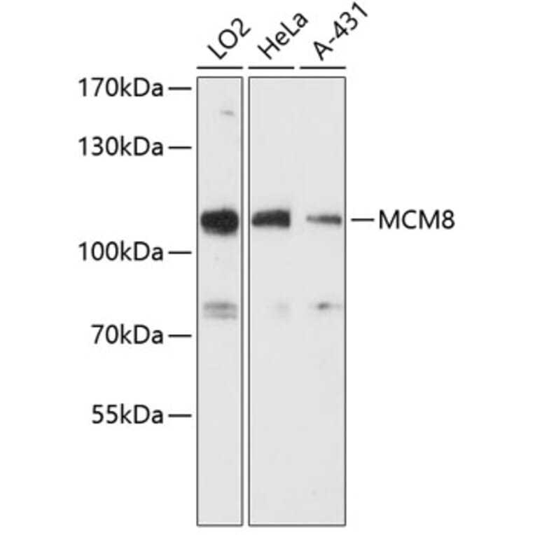 Western Blot - Anti-MCM8 Antibody (A87892) - Antibodies.com