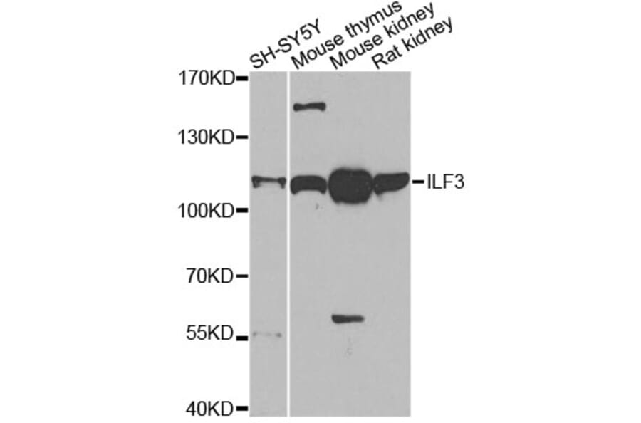 Western Blot - Anti-ILF3 Antibody (A14006) - Antibodies.com