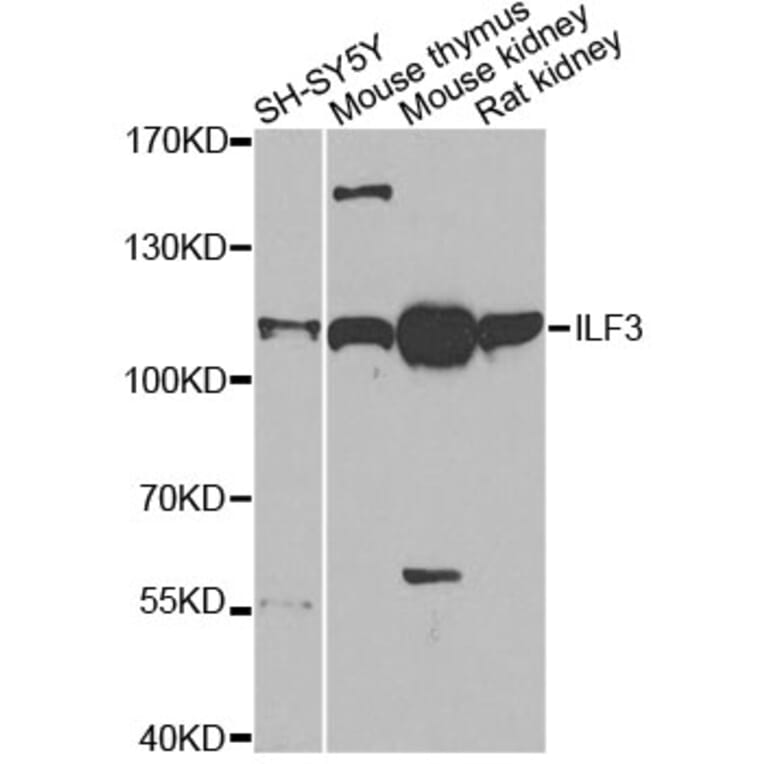 Western Blot - Anti-ILF3 Antibody (A14006) - Antibodies.com