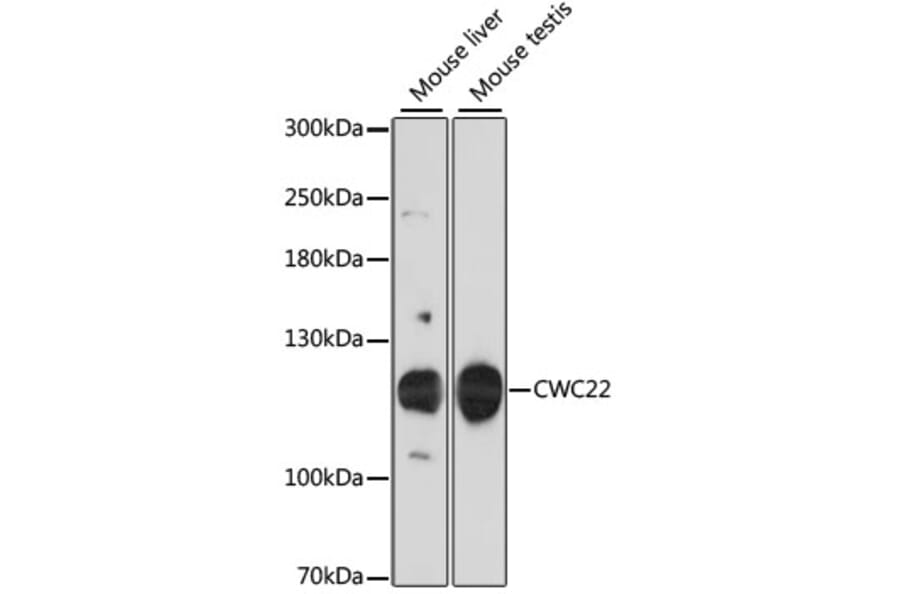Western Blot - Anti-NCM Antibody (A87894) - Antibodies.com