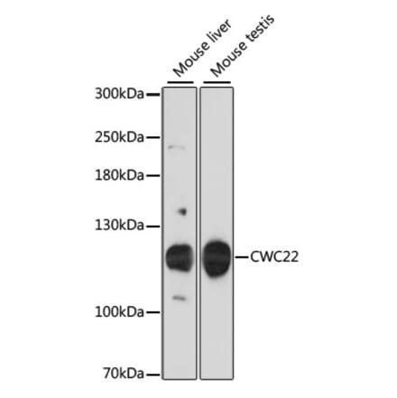 Western Blot - Anti-NCM Antibody (A87894) - Antibodies.com