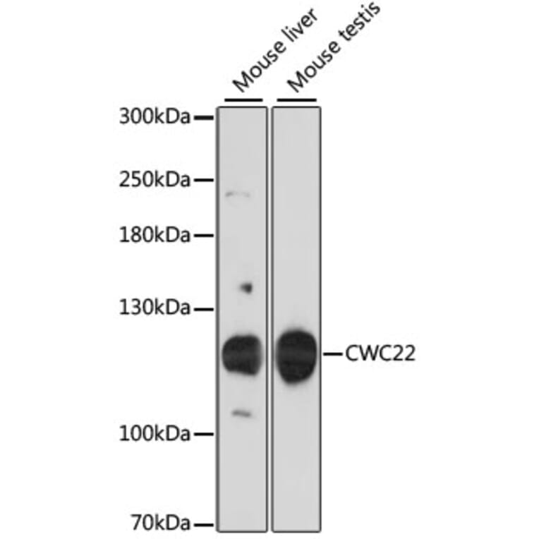 Western Blot - Anti-NCM Antibody (A87894) - Antibodies.com