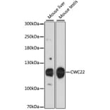 Western Blot - Anti-NCM Antibody (A87894) - Antibodies.com