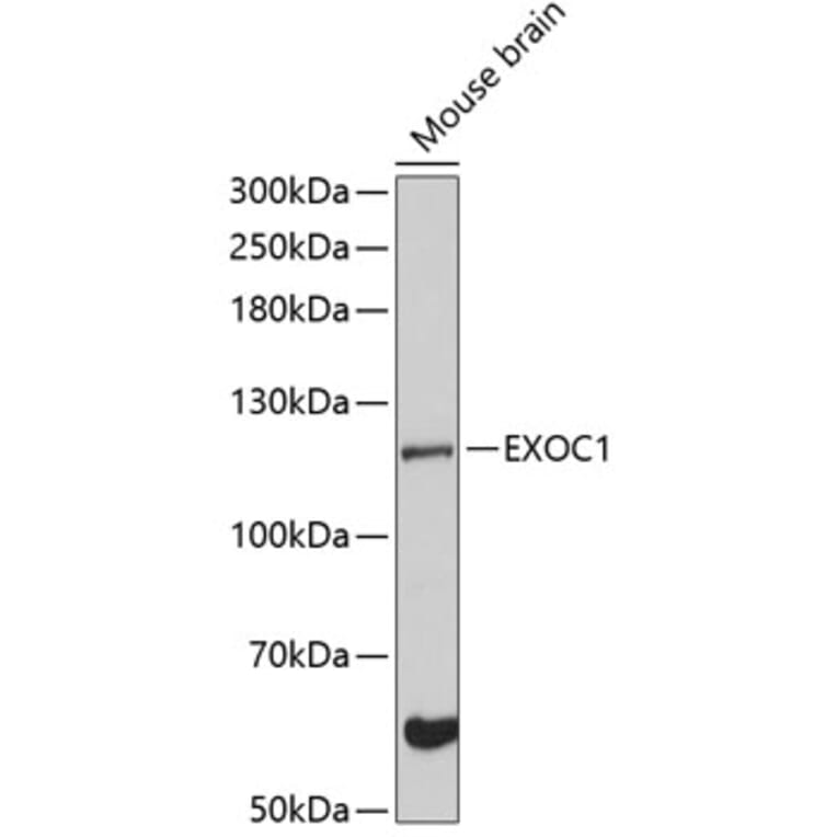 Western Blot - Anti-EXOC1 Antibody (A87895) - Antibodies.com