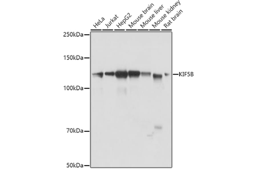 Western Blot - Anti-KIF5B Antibody (A87896) - Antibodies.com