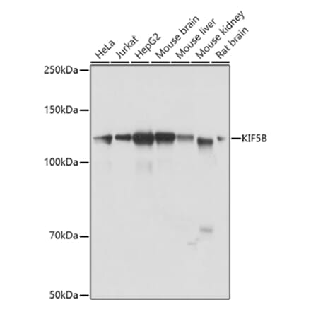 Western Blot - Anti-KIF5B Antibody (A87896) - Antibodies.com