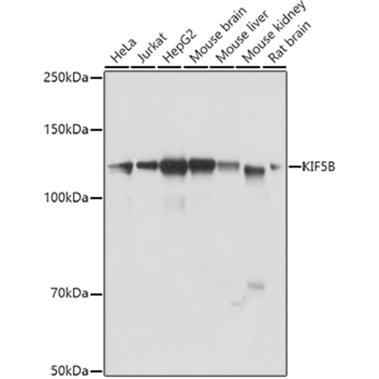 Western Blot - Anti-KIF5B Antibody (A87896) - Antibodies.com