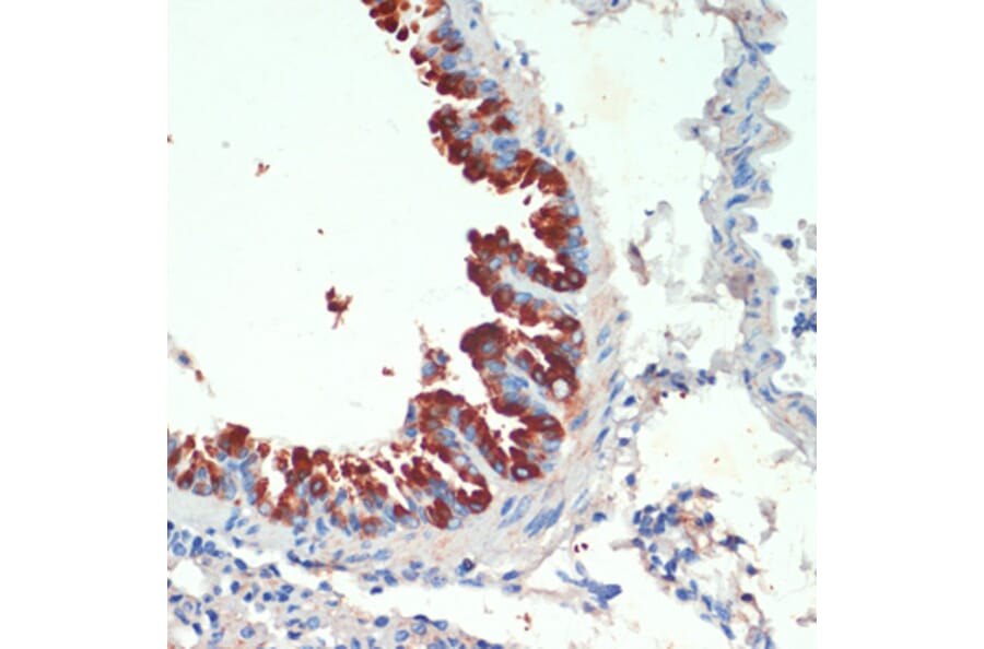 Immunohistochemistry - Anti-KIF5B Antibody (A87896) - Antibodies.com