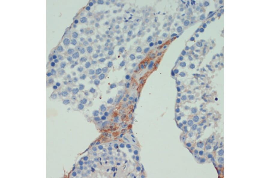 Immunohistochemistry - Anti-KIF5B Antibody (A87896) - Antibodies.com