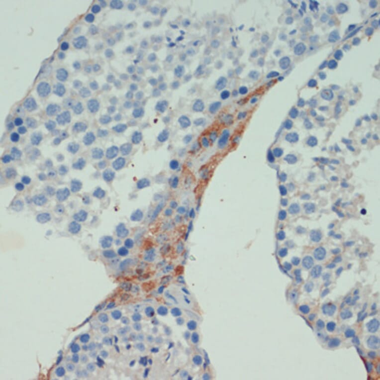 Immunohistochemistry - Anti-KIF5B Antibody (A87896) - Antibodies.com