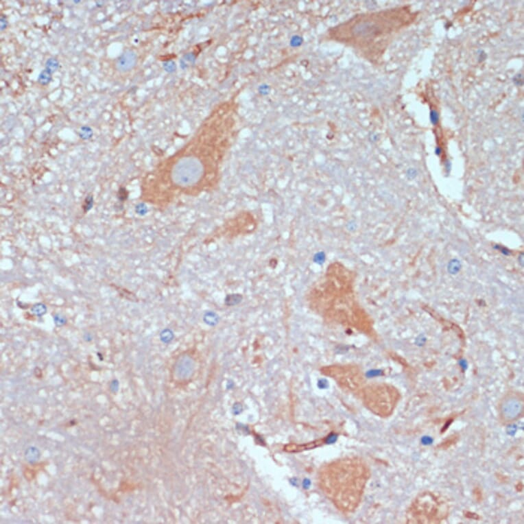 Immunohistochemistry - Anti-KIF5B Antibody (A87896) - Antibodies.com