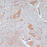 Immunohistochemistry - Anti-KIF5B Antibody (A87896) - Antibodies.com