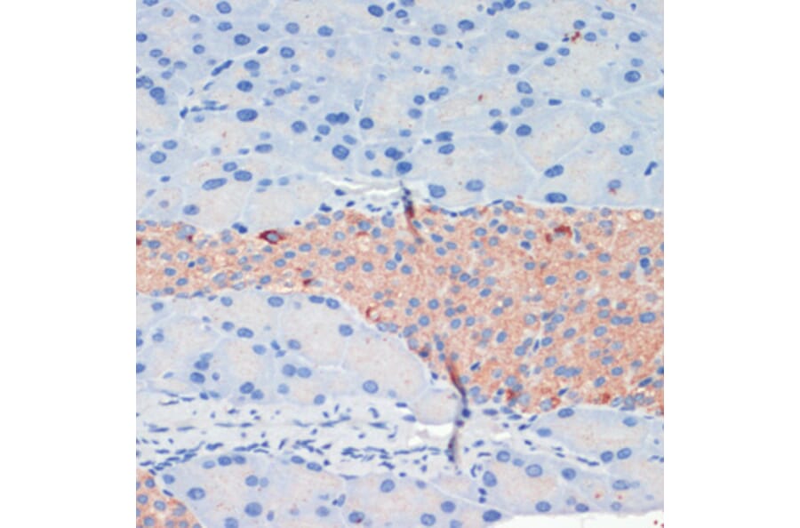 Immunohistochemistry - Anti-KIF5B Antibody (A87896) - Antibodies.com