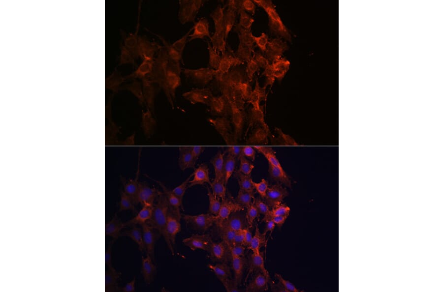 Immunofluorescence - Anti-KIF5B Antibody (A87896) - Antibodies.com