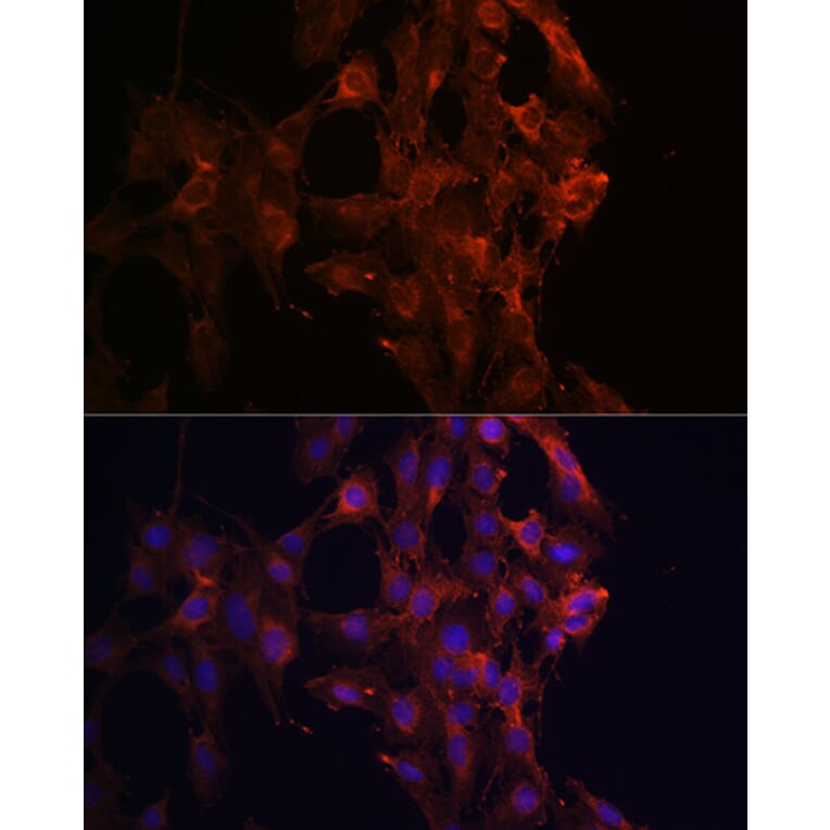 Immunofluorescence - Anti-KIF5B Antibody (A87896) - Antibodies.com