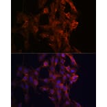 Immunofluorescence - Anti-KIF5B Antibody (A87896) - Antibodies.com