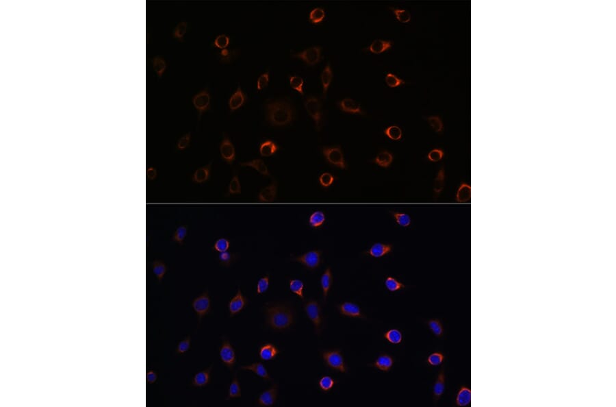 Immunofluorescence - Anti-KIF5B Antibody (A87896) - Antibodies.com