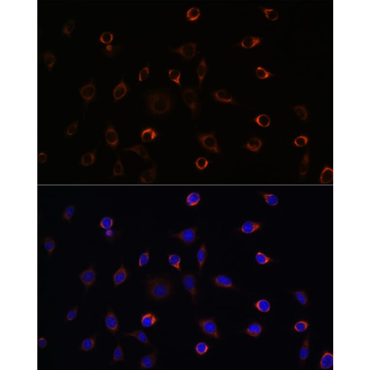 Immunofluorescence - Anti-KIF5B Antibody (A87896) - Antibodies.com