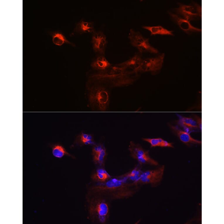 Immunofluorescence - Anti-KIF5B Antibody (A87896) - Antibodies.com