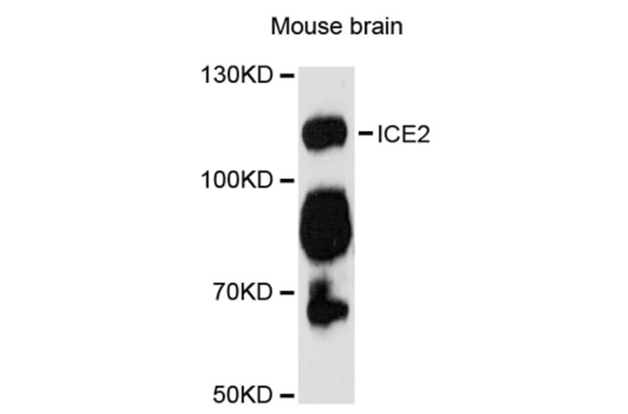 Western Blot - Anti-ICE2 Antibody (A12871) - Antibodies.com