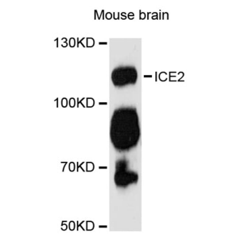 Western Blot - Anti-ICE2 Antibody (A12871) - Antibodies.com