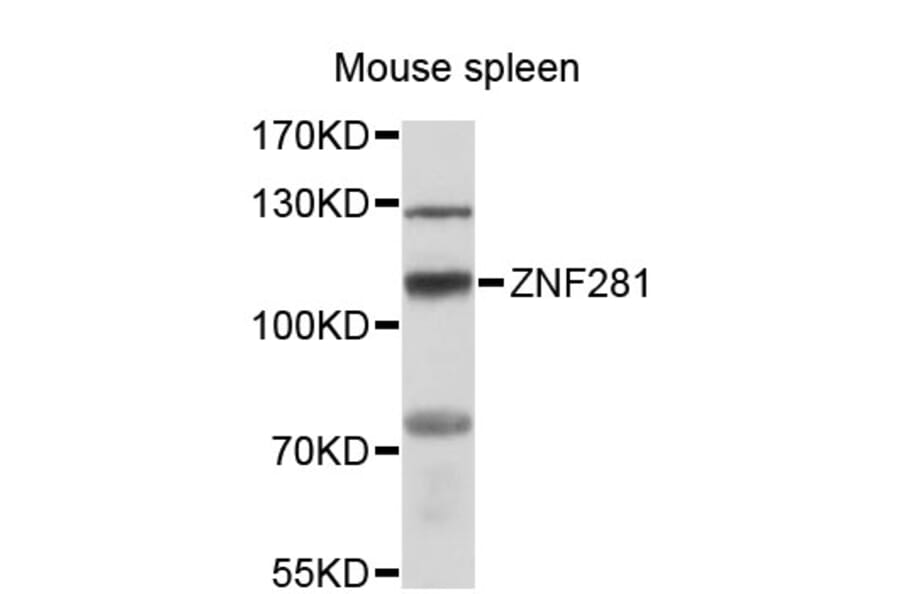 Western Blot - Anti-ZNF281 Antibody (A12650) - Antibodies.com