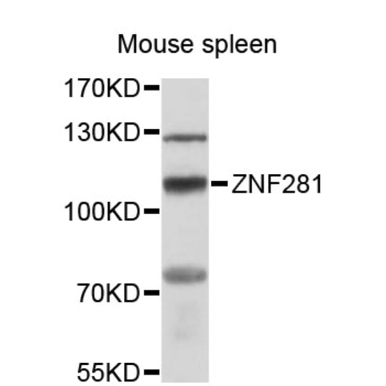 Western Blot - Anti-ZNF281 Antibody (A12650) - Antibodies.com