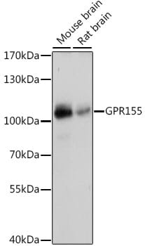 Western blot analysis of extracts of various cell lines, using Anti-GPR155 Antibody (A16173) at 1:1,000 dilution.
Secondary antibody: Goat Anti-Rabbit IgG (H+L) (HRP) (AS014) at 1:10,000 dilution.
Lysates / proteins: 25µg per lane.
Blocking buffer: 3% non-fat dry milk in TBST.
Detection: ECL Basic Kit (RM00020).
Exposure time: 5s.