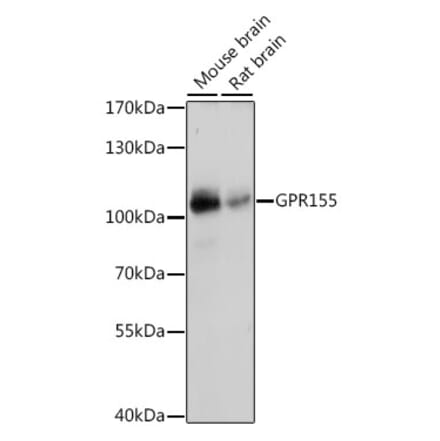 Western Blot - Anti-GPR155 Antibody (A87899) - Antibodies.com
