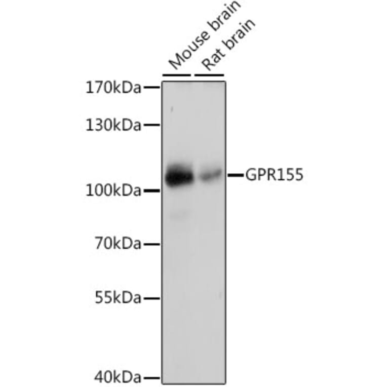 Western Blot - Anti-GPR155 Antibody (A87899) - Antibodies.com