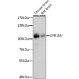 Western Blot - Anti-GPR155 Antibody (A87899) - Antibodies.com
