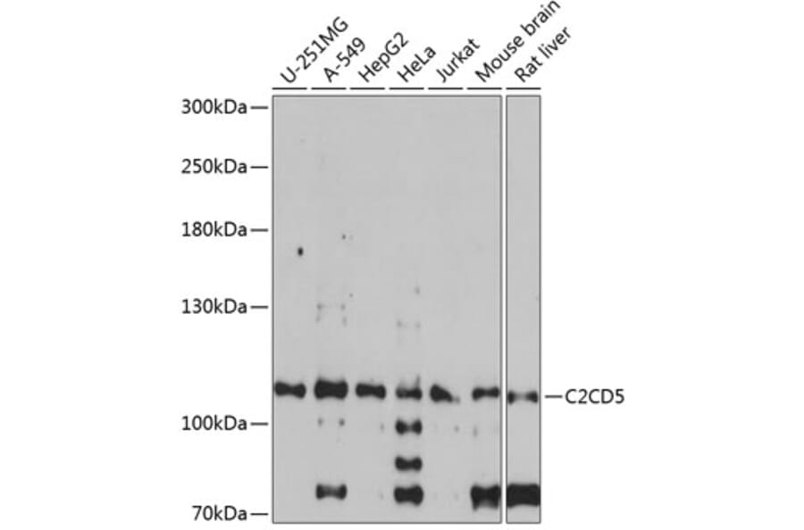 Western Blot - Anti-KIAA0528 Antibody (A87900) - Antibodies.com