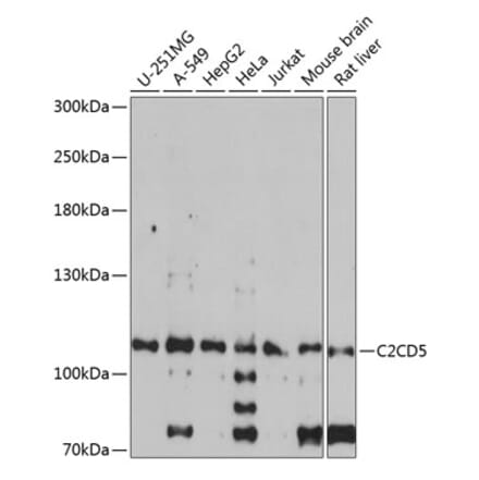 Western Blot - Anti-KIAA0528 Antibody (A87900) - Antibodies.com