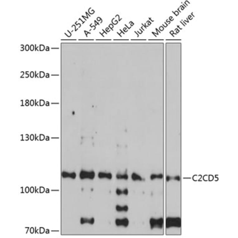 Western Blot - Anti-KIAA0528 Antibody (A87900) - Antibodies.com