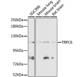 Western Blot - Anti-TRPC6 Antibody (A87901) - Antibodies.com