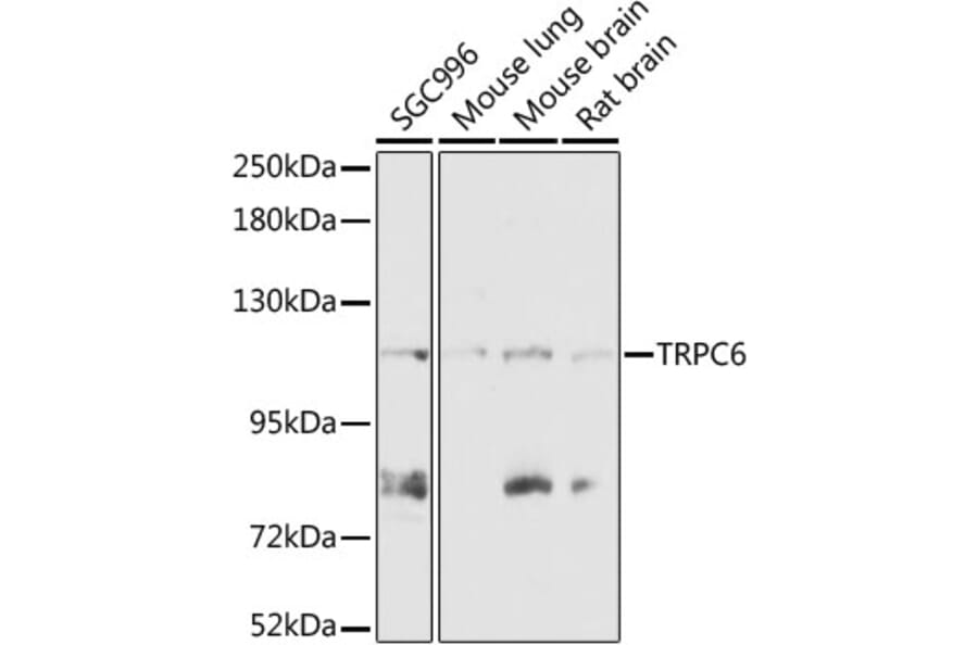 Western Blot - Anti-TRPC6 Antibody (A87901) - Antibodies.com