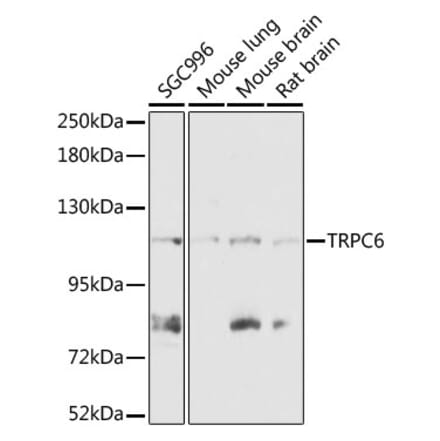 Western Blot - Anti-TRPC6 Antibody (A87901) - Antibodies.com