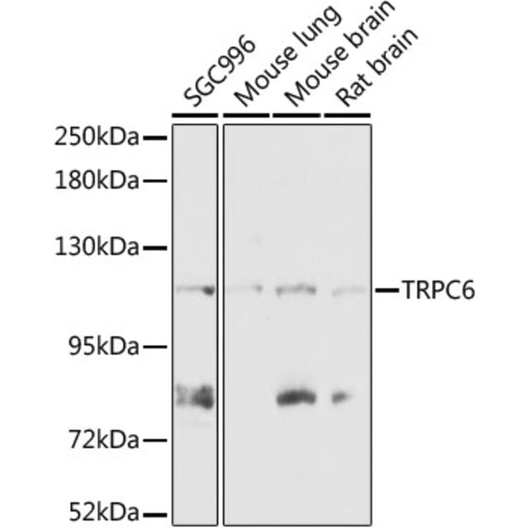 Western Blot - Anti-TRPC6 Antibody (A87901) - Antibodies.com