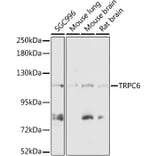 Western Blot - Anti-TRPC6 Antibody (A87901) - Antibodies.com