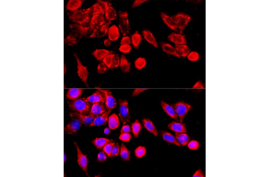 Immunofluorescence - Anti-TRPC6 Antibody (A87901) - Antibodies.com