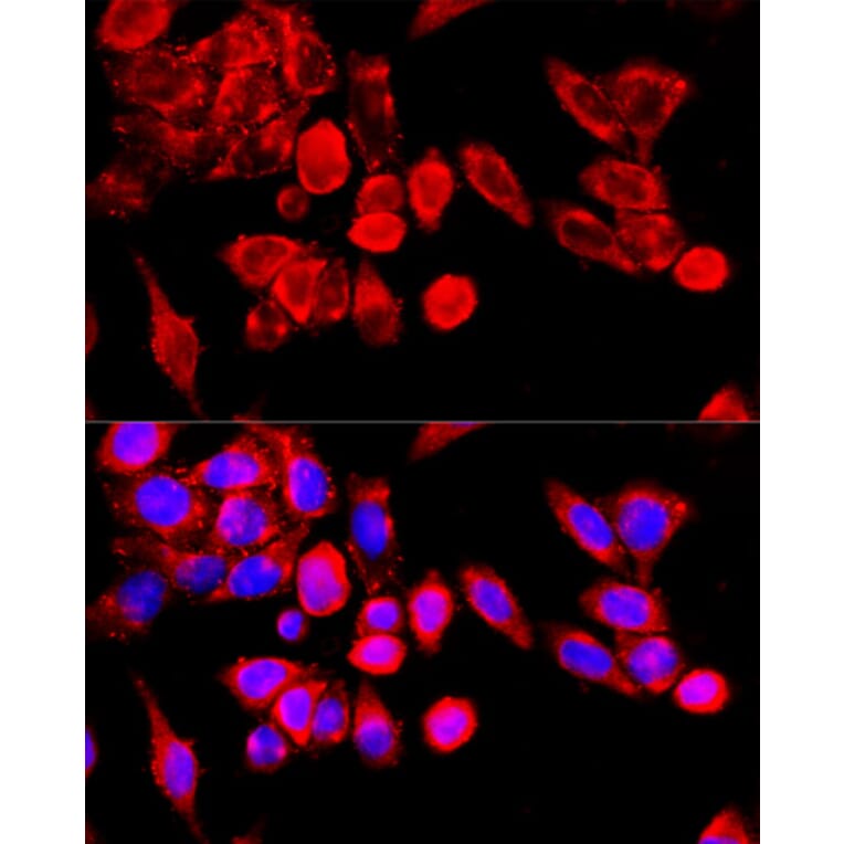 Immunofluorescence - Anti-TRPC6 Antibody (A87901) - Antibodies.com