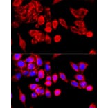 Immunofluorescence - Anti-TRPC6 Antibody (A87901) - Antibodies.com