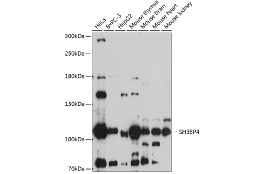 Western Blot - Anti-SH3BP4 Antibody (A87902) - Antibodies.com