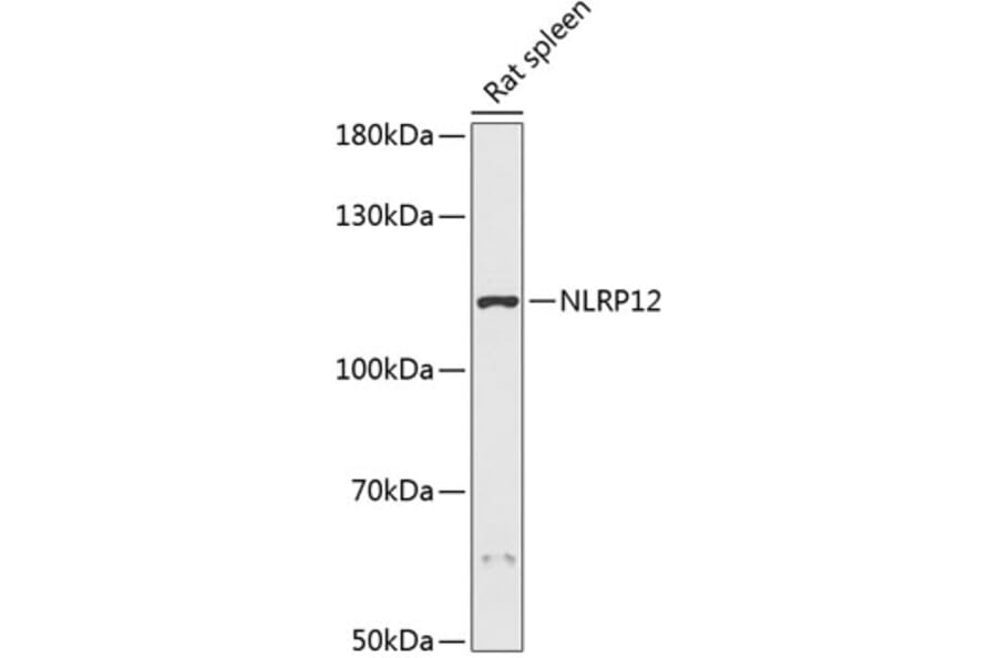 Western Blot - Anti-NALP12/NLRP12 Antibody (A87903) - Antibodies.com