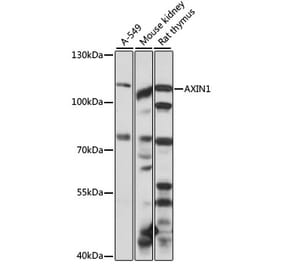 Western Blot - Anti-Axin 1 Antibody (A87905) - Antibodies.com