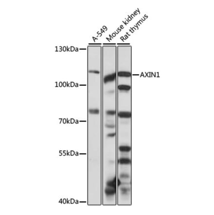 Western Blot - Anti-Axin 1 Antibody (A87905) - Antibodies.com