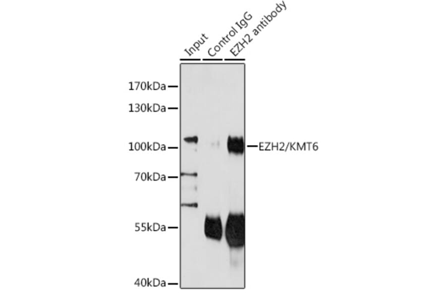 Western Blot - Anti-EZH2 Antibody (A87907) - Antibodies.com