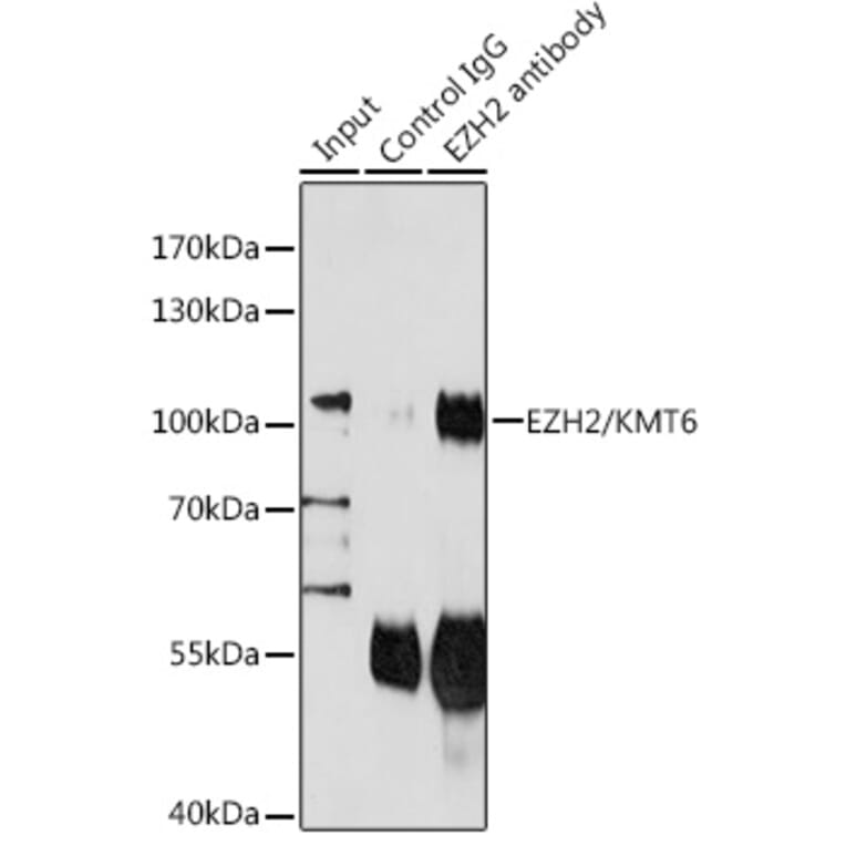 Western Blot - Anti-EZH2 Antibody (A87907) - Antibodies.com