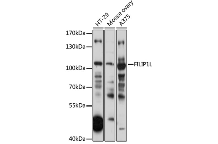 Western Blot - Anti-FILIP1L Antibody (A87908) - Antibodies.com